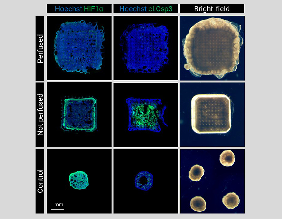 Immunofluorescence images show evidence of cell death in the inner core of the control organoid and the non-perfused tissue (Csp3, green, middle column) and its absence in the perfused organoid. The samples stained for HIF1α (green, left column), indicate high levels of oxygen starvation in the control and non-perfused organoids.